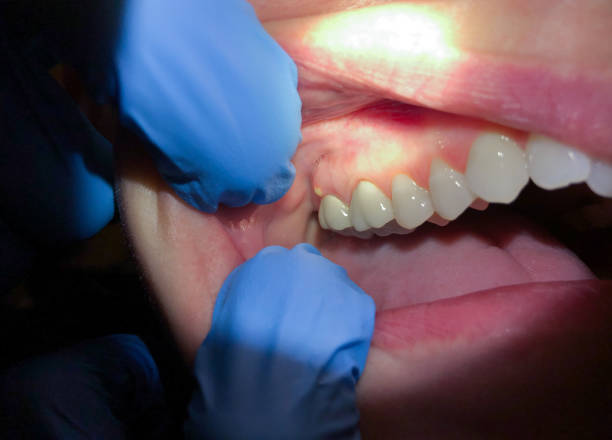 Best Teeth Whitening  in Roosevelt Park, MI