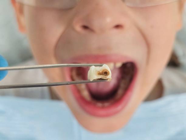 Best Emergency Tooth Extraction  in Roosevelt Park, MI